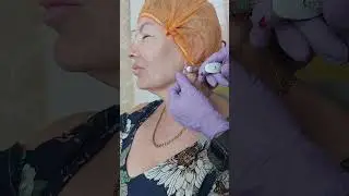15.07 Углы нижней челюсти.