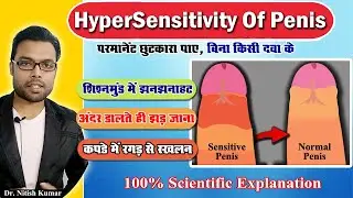 How to reduce Hypersensitivity of Glans | Sensitive glans Treatment | Dr. Nitish Kumar