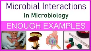 Microbial Interactions in Microbiology | Types | Explained with Enough Examples