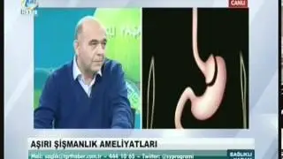 Obezite ameliyatları 2014 TGRT