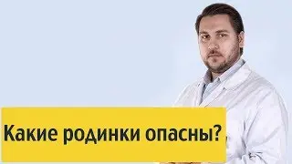 Какие родинки опасны?