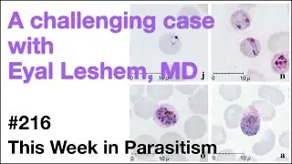 TWiP 216: A challenging case