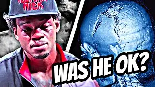 HAS ERROL SPENCE JR SUFFERED MORE DAMAGE FROM TERENCE CRAWFORD?? • IS RETIREMENT AN OPTION..