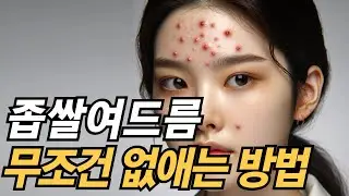 좁쌀여드름 이 영상 하나면 싹 다 없앨 수 있습니다. 좁쌀여드름 없애는 방법부터 좁쌀꿀템 추천까지