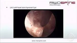 RIWOspine International Symposium Case Presentations, March 2019, Herne, Germany