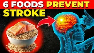 6 Foods To Prevent Stroke And Recover From Stroke (Stroke Prevention)