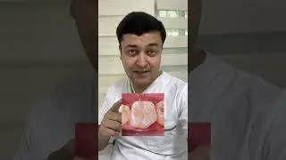 Кариес чихел табобат мешавад?