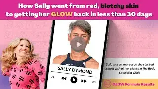 How Sally went from red, blotchy skin to getting her GLOW back in less than 30 days