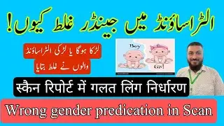 Gender reveal ultrasound | Ghalt ultrasound gender reveal | wrong prediction of baby gender