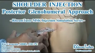 Shoulder (Glenohumeral) Injection - Posterior Approach