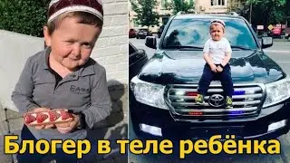 Как Живет Самый маленький человек Хасбулла и чем он болен