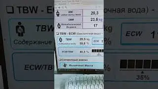 Биоимпедансный анализ тела и показатели воды в организме. Отёчность.