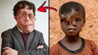 STRANGEST People Who Were Born Different