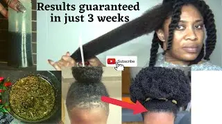 I'm shocked!! This Oil has been proven to work miraculously to stop Hair Loss & Thicken hair faster.