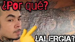 Sarpullido en tatuaje cicatrizado | ¿por qué salen granos en un tattoo?