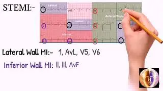 ECG/EKG: Step by Step Interpretation ||(how to read ECG)!!
