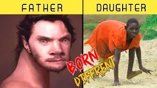 Born Different In The World | People Born Different