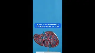 What’s the difference between HSCRP vs. CRP