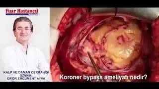 [ÖZEL FUAR HASTANESİ] 3 damar bypass (KALP AMELİYATI)