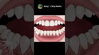 ASMR Animation | Water Flosser for Teeth! Remove Heavy Tartar! | Meng's Stop Motion