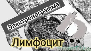 ЛИМФОЦИТ (электронограмма)