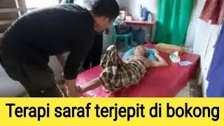 Pinched nerve therapy, spinal cord nerve, tailbone nerve pinched 