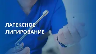 Латексное лигирование