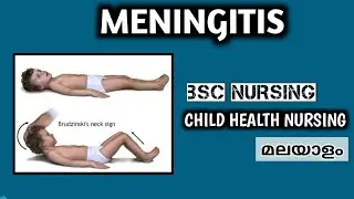 Meningitis Malayalam | Etiology, Symptoms, Diagnosis & Treatment | 3rd Year BSc Nursing Lecture /CHN