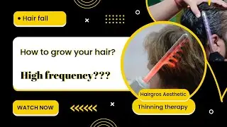 High Frequency Therapy For Hair | Hair Thinning | REGROW Hair | Receding Hairline | #Hairgros