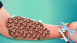 ASMR Glasses Injured Treatment /Hand Injury  @ASMRanimation1234 #asmr