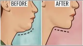 GIDIK ERİTEN MASKE