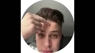 Фогель про волосы