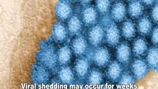 Norovirus
