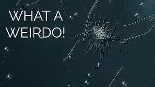 The Weirdest Amoeba Ever!