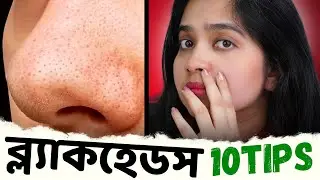 ✔ BLACKHEADS / ব্ল্যাকহেডস দূর করার ১০টি বৈজ্ঞানিক উপায় । টিনএজ - এডালট সবার জন্য রুটিন