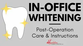What To Do After Getting Your Teeth Whitened at the Dentist | #experienceHFD