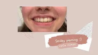 Smiley piercing, avagy ínyfék piercing szúrása