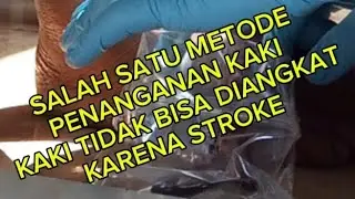 PENANGANAN STROKE KAKI TIDAK BISA DIANGKAT