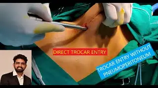 DIRECT TROCAR ENTRY