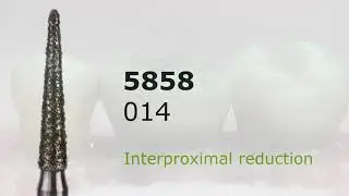 Posterior crown preparation
