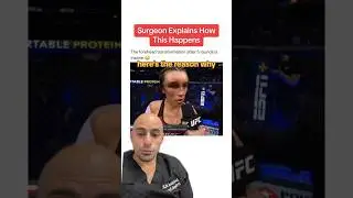 Doctor Explains UFC Moment #shorts