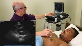 Advanced Critical Care Echocardiography - Complete Exam