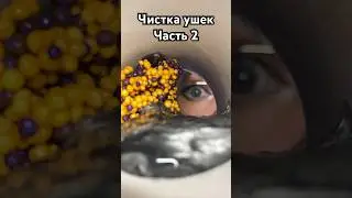 Чистка ушек, часть 2 