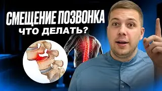 СПОНДИЛОЛИСТЕЗ. Что такое НАСТОЯЩЕЕ смещение позвонка? Что с этим делать?
