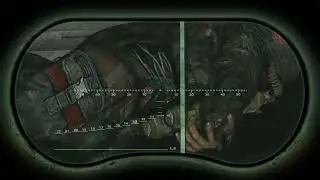 S.T.A.L.K.E.R. - Ow My Leg