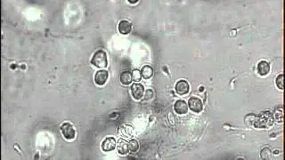 ПКТ отрицательный 1