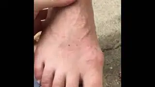 young french girl feet 2024