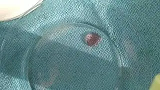 Себозол, шампунь от перхоти. Действительно помог. Как выглядит шампунь, цвет и тягучесть