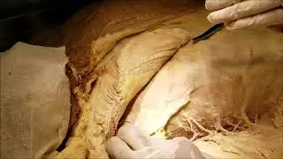 Pectoralis Major-Minor Serratus Anterior and Nerve Supply - Sanjoy Sanyal