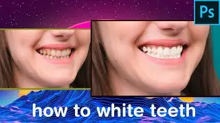 How to white yellow teeth. easiest way.